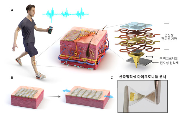신축·접착성 마이크로니들 센서.[KAIST 제공]
