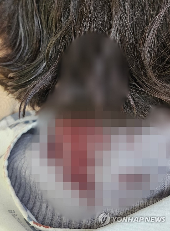 배현진 의원 피습 직후 촬영된 사진. 회색 니트의 목주변에 다량의 혈흔이 묻어 있다. [배현진 의원실 제공]