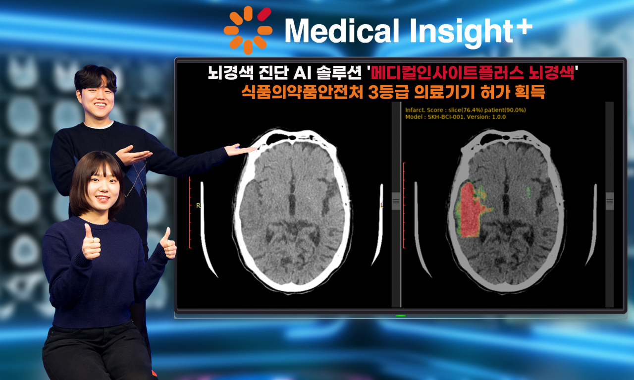 SK C&C의 뇌경색 진단 AI솔루션 ‘메디컬인사이트 플러스 뇌경색’을 소개하고 있다. [SK C&C 제공]