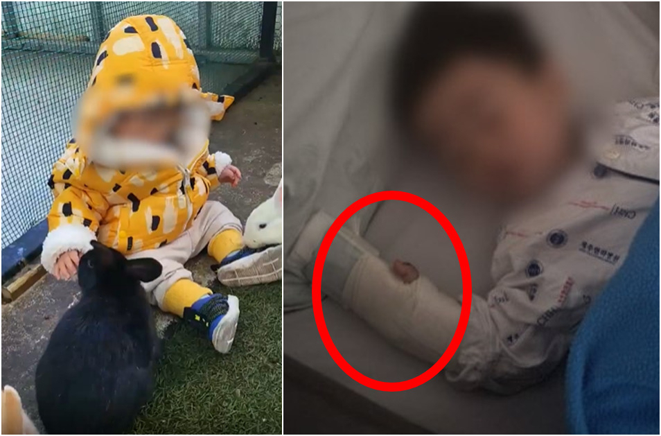작성자 A씨가 공개한 15개월 아기. 동물원에서 토끼에게 손가락을 물리는 사고를 당했다. [온라인 커뮤니티]