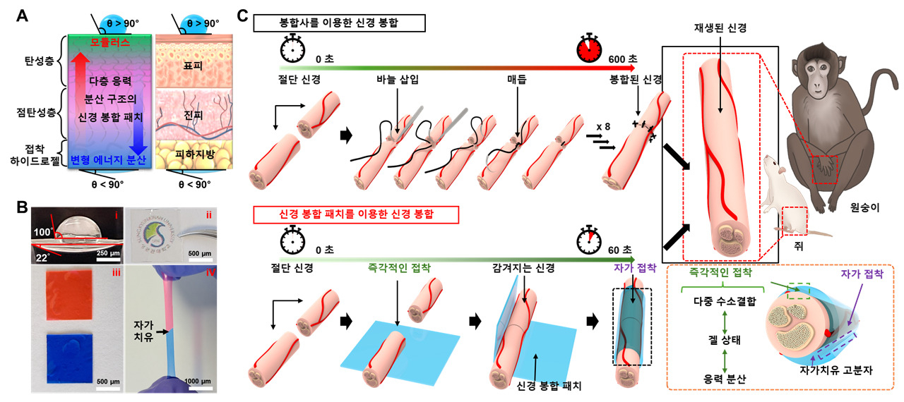 신경 봉합 패치의 개념도 및 적용과정.[성균관대학교 제공]