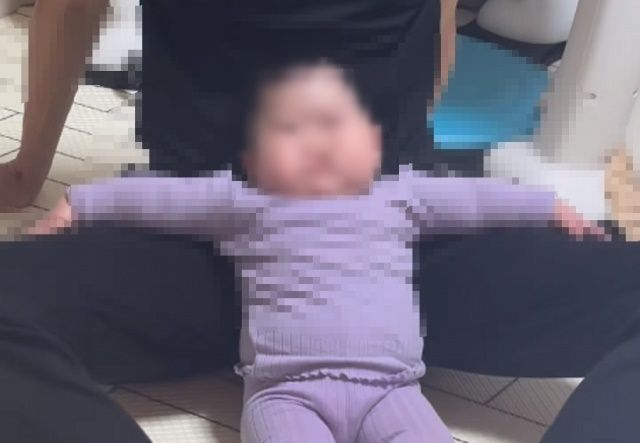 구순구개월 수술을 앞두고 의사가 무기한 수술을 연기시킨 아기. [인스타그램]