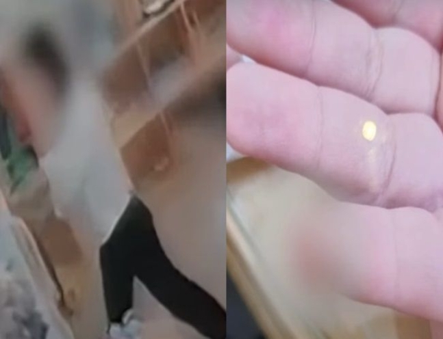 경기도 수원의 한 유치원에서 4세 남아의 손가락이 문에 끼어 절단된 사고 발생했다. 당시 유치원 교사가 문을 닫고 있는 모습(왼쪽)과 철심을 받은 아이의 손가락. [MBC 보도화면 갈무리]