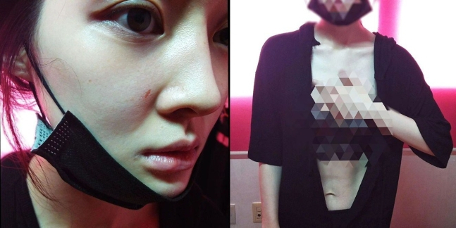 This photo posted by Lee A-reum shows a mark on her face and her torn clothes, which she says are evidence of domestic abuse. (Lee A-reum's Instagram page)