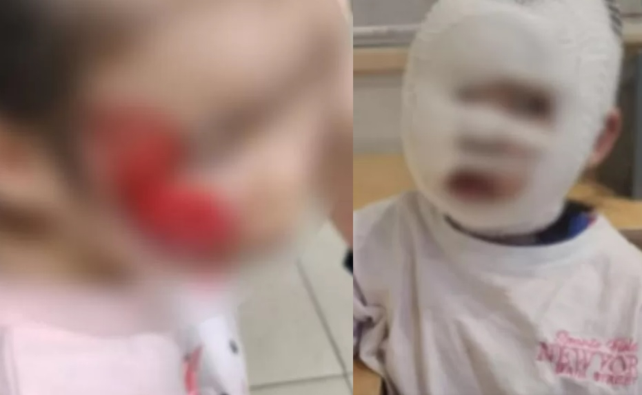 포천 깡통열차 전복사고 피해 아동 모습[온라인 커뮤니티 캡처]