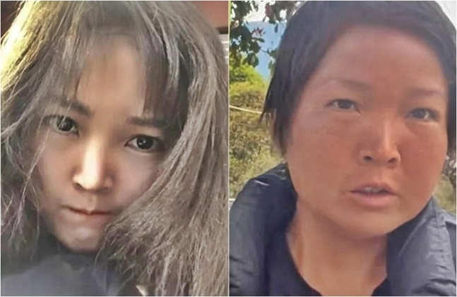 20대女얼굴, 60대 할머니 됐다…대체 무슨 일이 있었길래 [차이나픽]