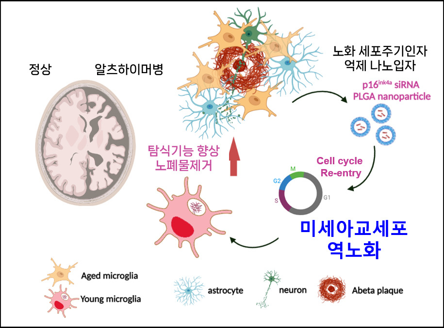 “늙은 세포를 젊은 세포로 역노화 시켰더니” 난치성 치매, 치료가능성 높였다