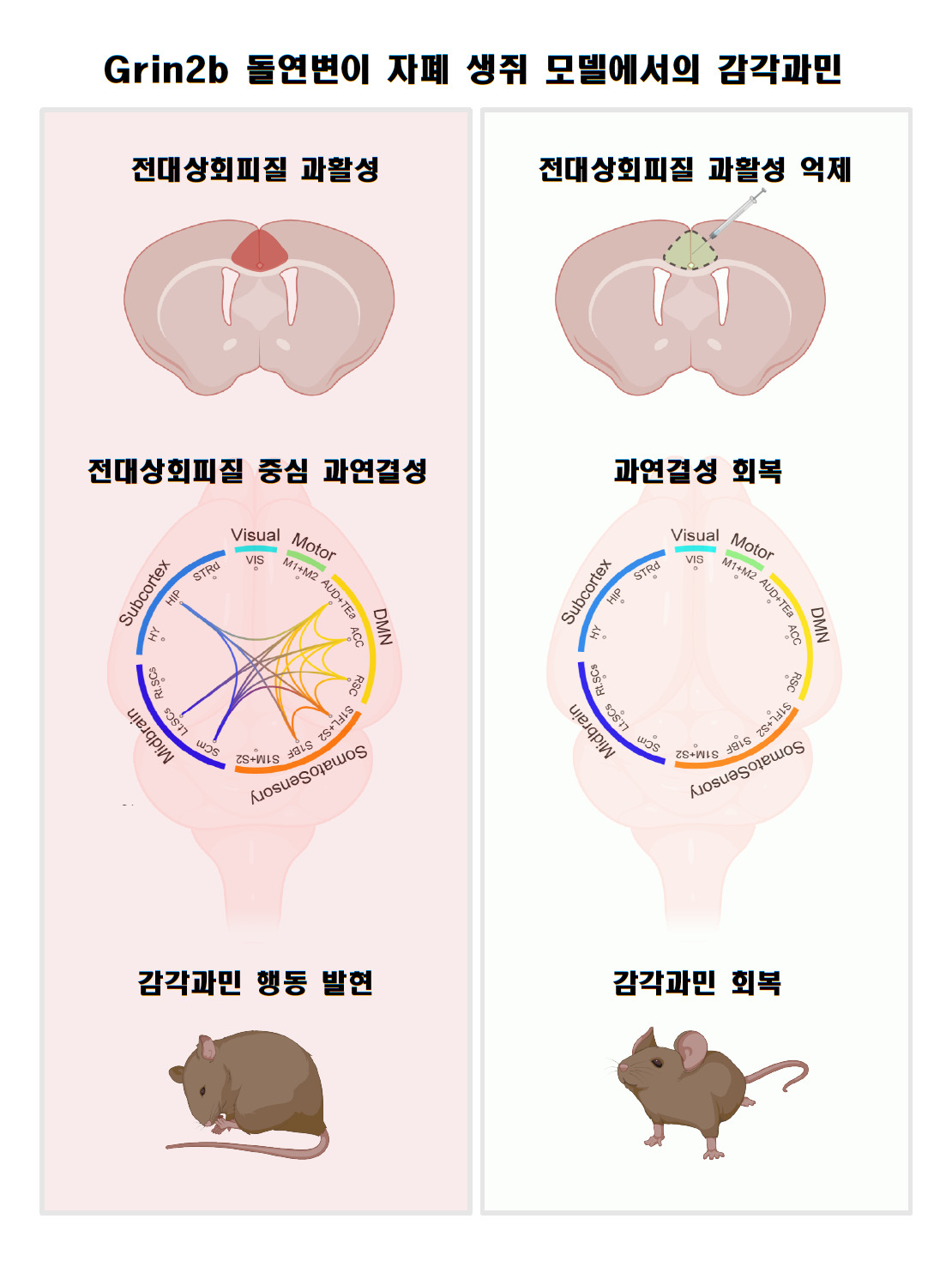 “36명당 1명, 무서운 자폐스펙트럼장애”…감각 예민해지는 원인 찾았다