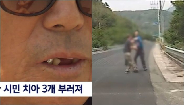 SBS 보도화면 캡처
