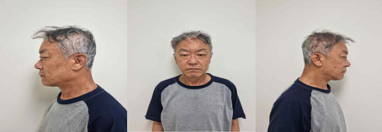 피의자 박학선(65) 머그샷. [서울경찰청 제공]