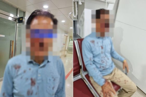승객에게 폭행을 당한 택시기사 B씨. [온라인 커뮤니티]