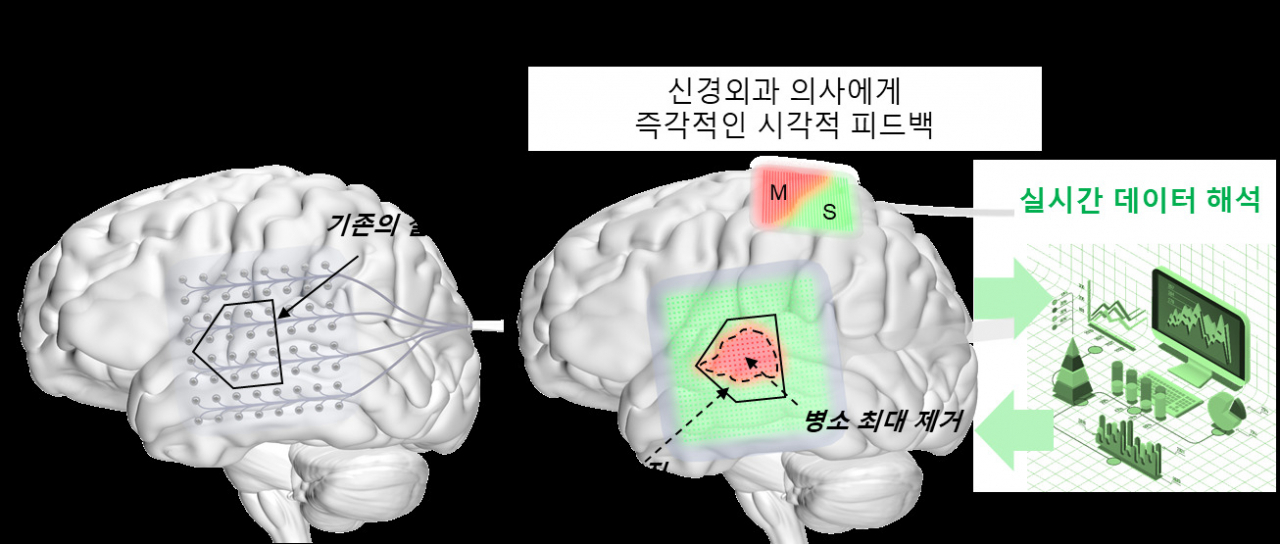 마이크로디스플레이를 이용한 뇌의 기능적 지도 시각화가 가능해질 경우의 기대효과.[UNIST 제공]