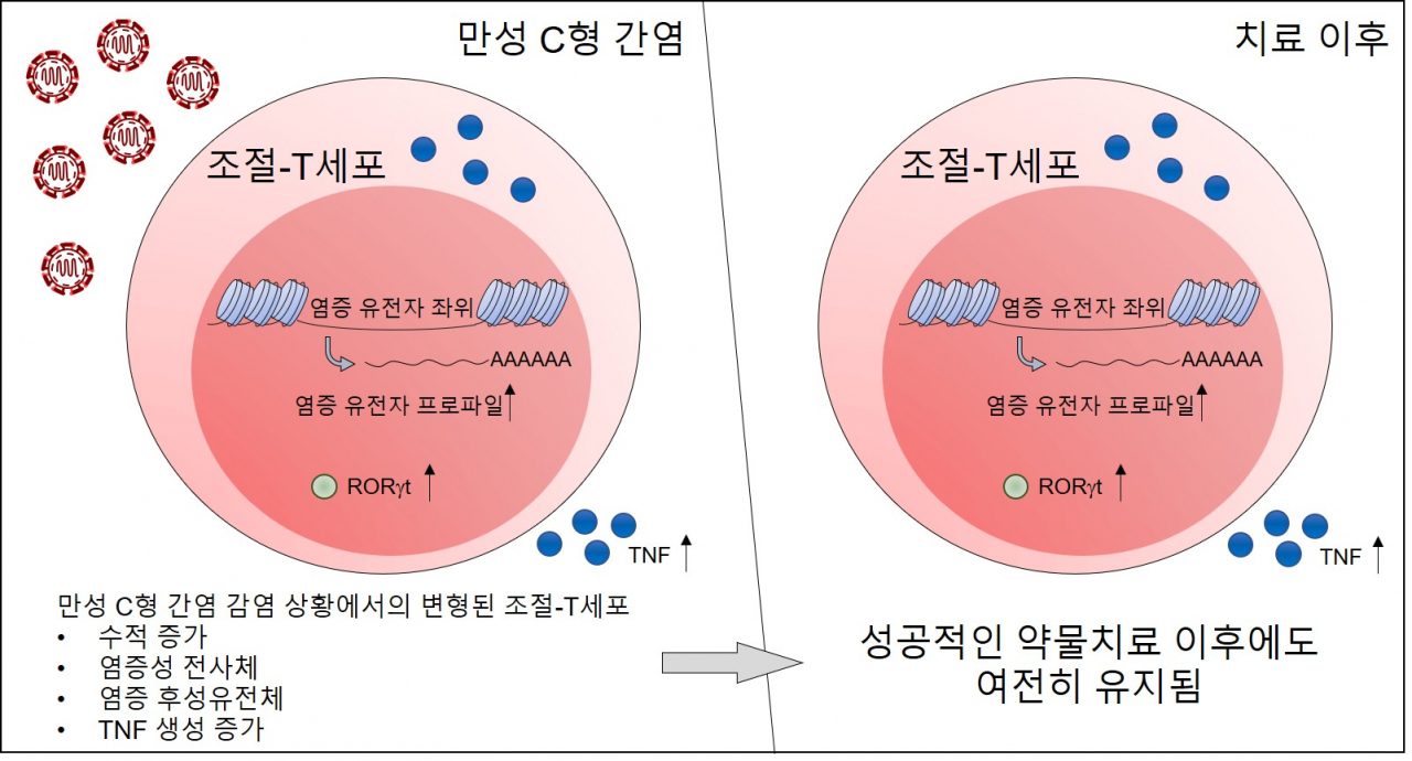 만성 C형 간염 환자의 항바이러스제 약물치료 이후에도 조절 T세포에 염증성 흔적이 남는다는 연구 결과 모식도.[IBS 제공]