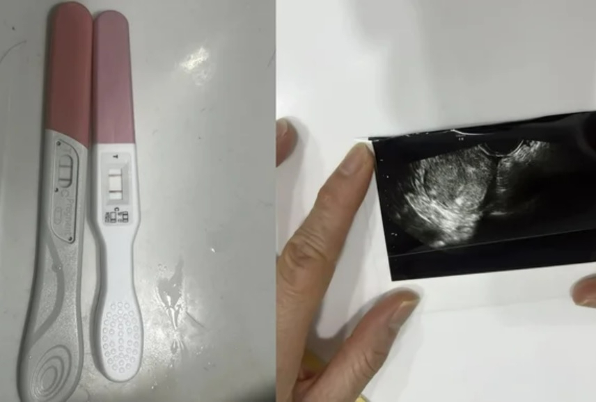 유명 프로야구 선수와 교제하다 임신하고 낙태까지 하게 됐다는 여성팬이 올린 사진[포스타입 캡처]