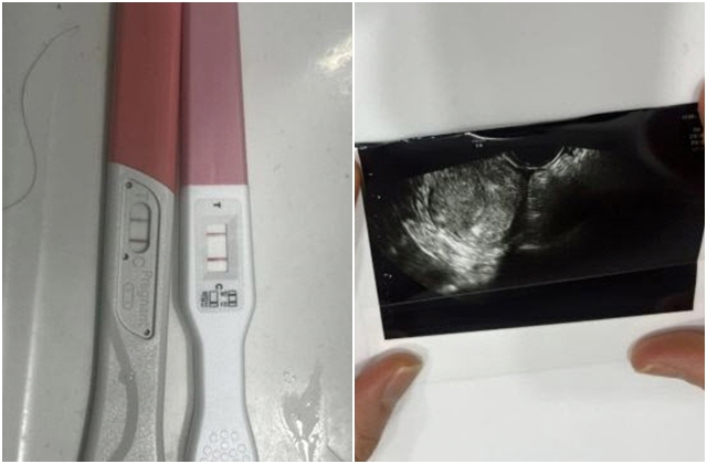 국가대표 출신 프로야구 선수의 아이를 임신했다가 낙태했다는 여성 A씨가 공개한 증거 사진. [온라인 커뮤니티]