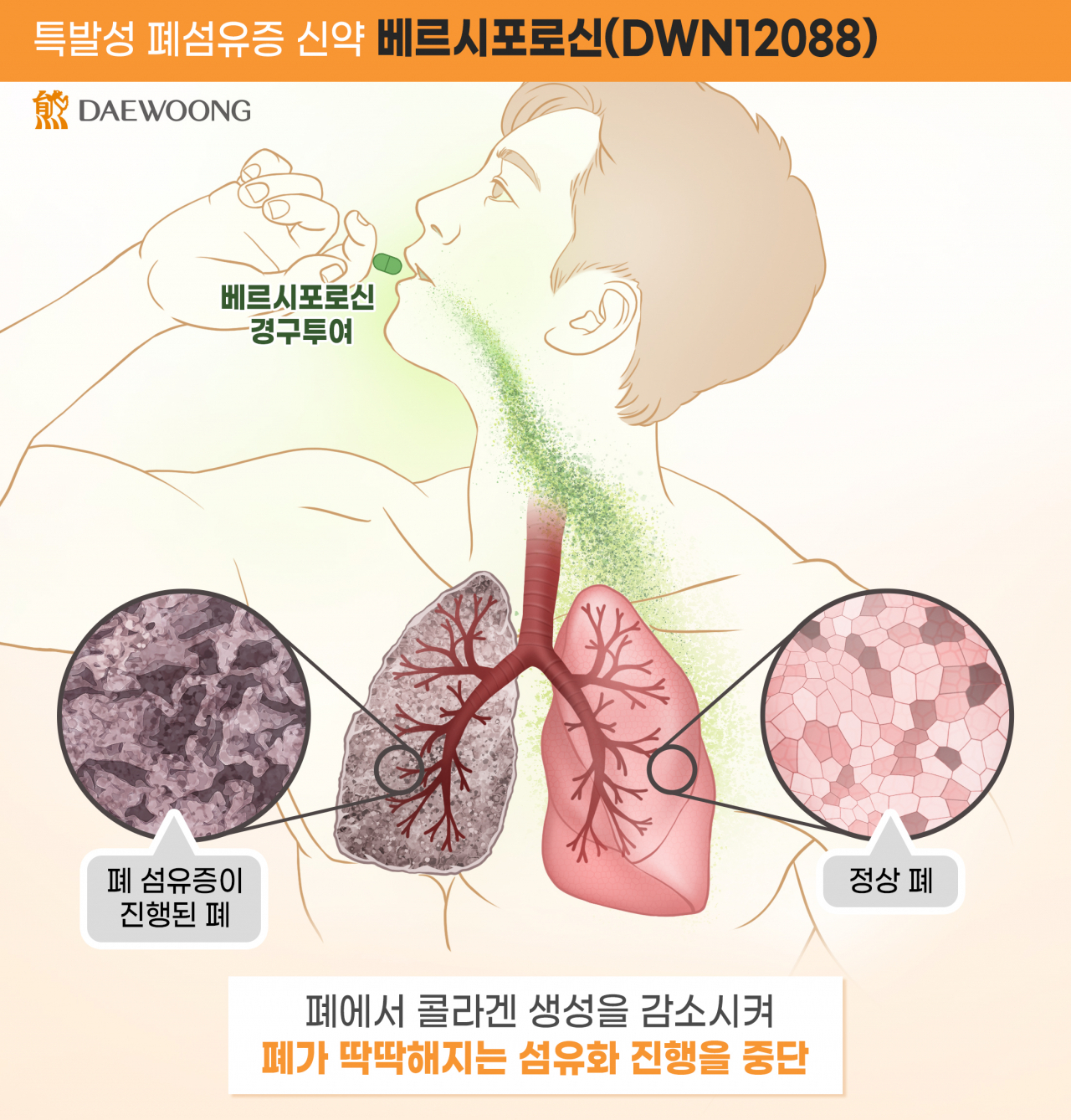 대웅제약 베르시포로신(DWN12088) 작용 기전 [대웅제약 제공]