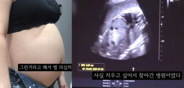 20대 여성 유튜버가 지난 7월 임신 36주차 태아의 초음파 사진을 공개하면서 낙태사실을 알려 '영아 살해' 논란에 휩싸였다. [유튜브 캡처]
