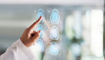 Stroke patients in Korea show more history of smoking, diabetes: report