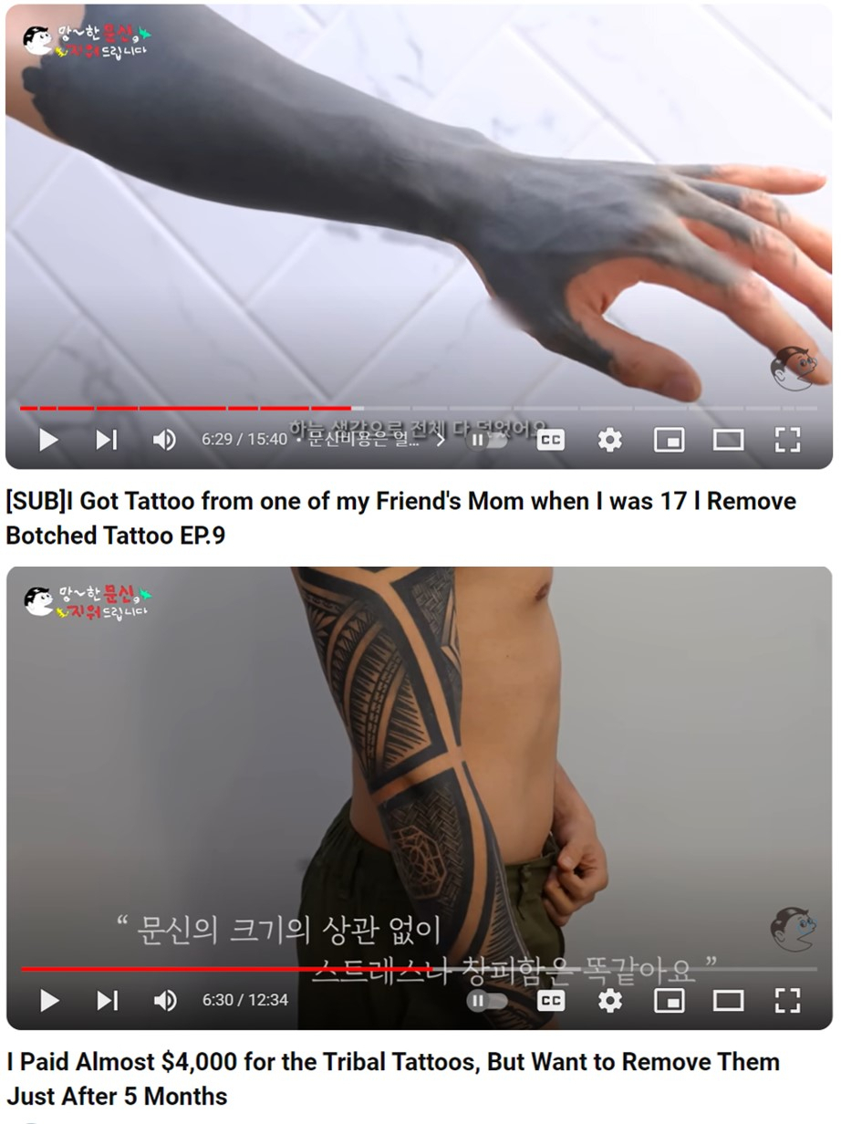 Screenshots from YouTube channel "Dr. Young-soo, Tattoo Removal Specialist"
