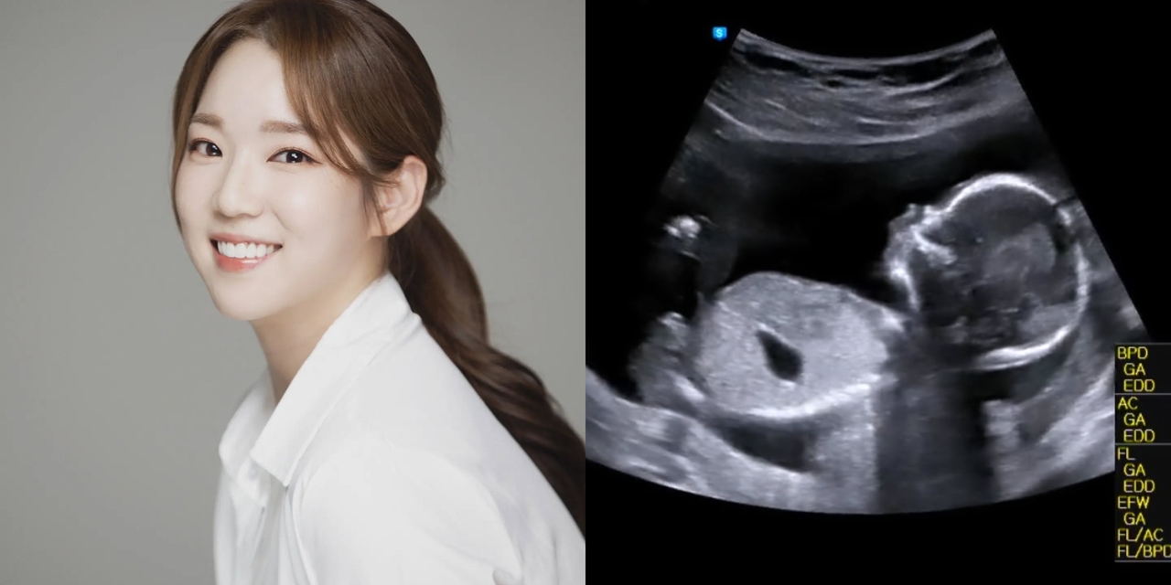 송문선 채널