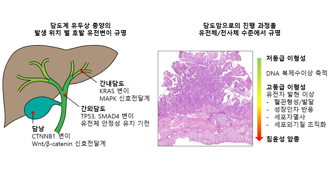 담도계 전암 병변으로부터 담도암의 발생 과정에서 나타나는 유전자 변이와 유전자 발현 이상 양상.[연세대 의대 제공]