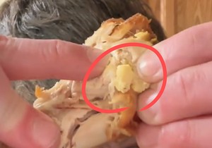 “어제도 치킨 먹었는데” 한입 물었더니 ‘노란색’ 고름이 툭…끔찍한 정체 [지구, 뭐래?]