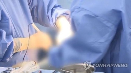 ‘예뻐지려 한 지방흡입 수술, 안면마비라니’ 법원 “5600만원 배상” [세상&]
