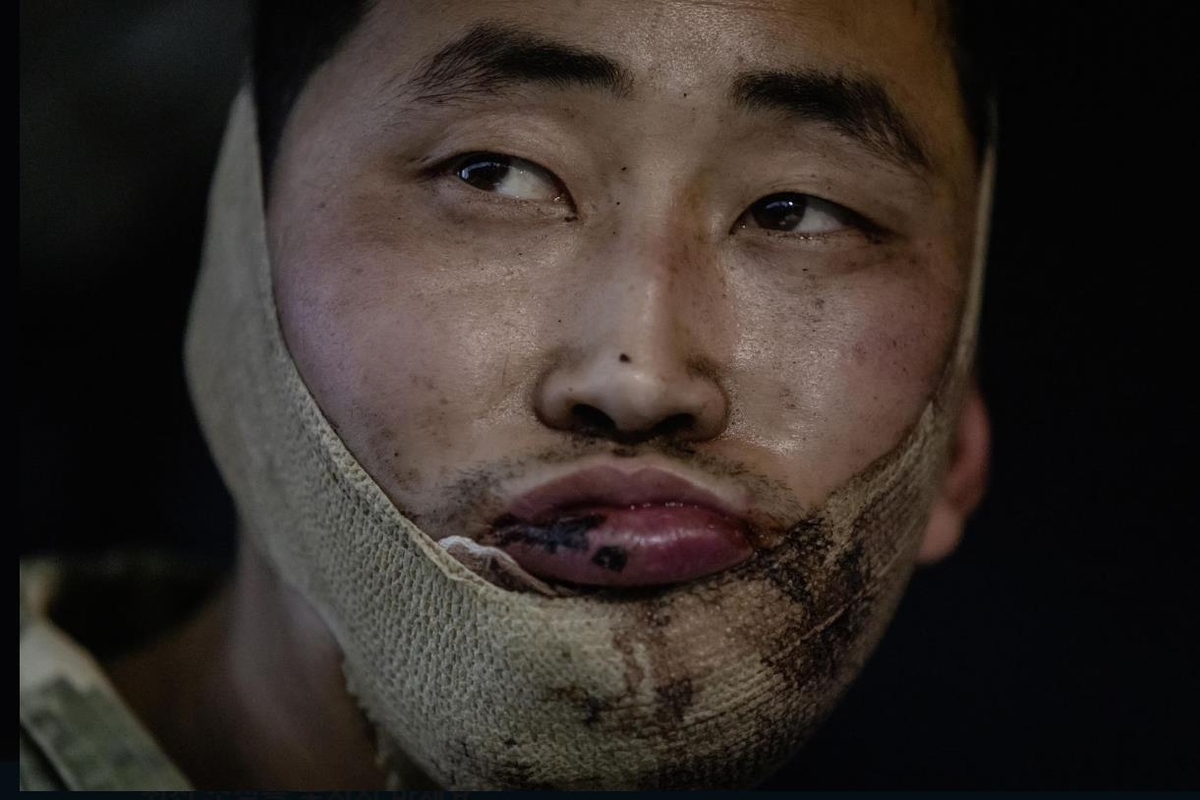 A wounded soldier, suspected to be North Korean and captured by Ukrainian forces in Russia's western Kursk region, is seen in this file photo posted on Jan. 11. (Zelenskyy's X account)