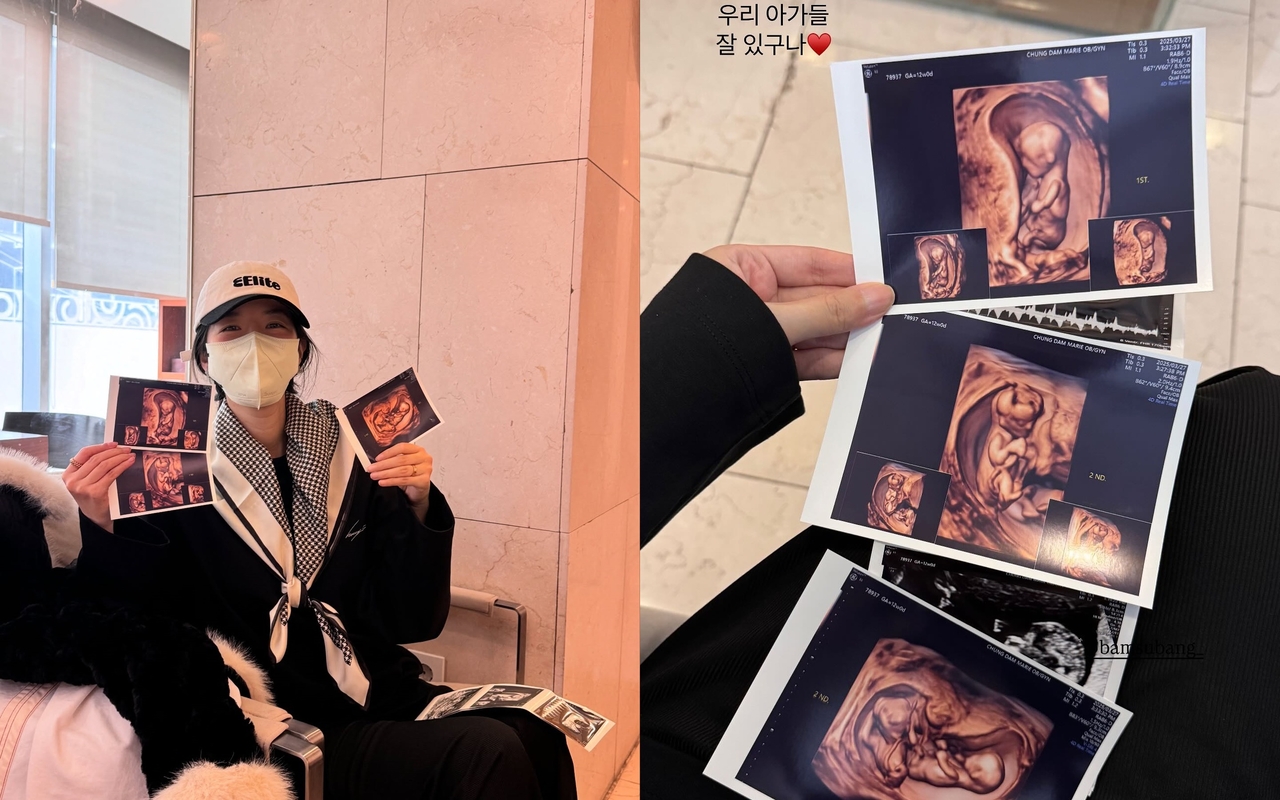 사진=김지혜 SNS