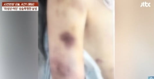 미성년자인 여자친구를 가스라이팅하고 폭행해 장기 일부를 파손시키기 까지 한 20대 남성이 2심에서 더 무거운 형을 선고받았다. [JTBC ‘사건반장’]
