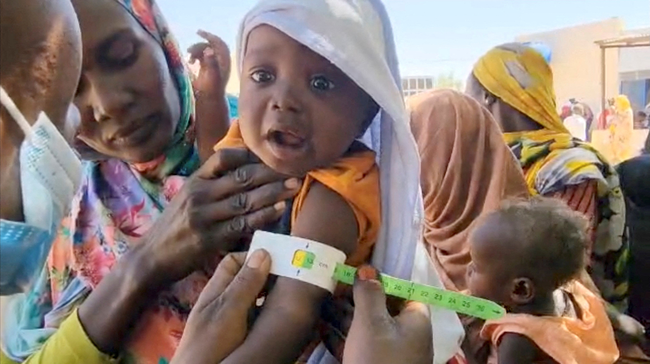 A child gets tested for malnutrition at World Food Program camp at El Fasher, in Darfur, Sudan, March 27. (Reuters-Yonhap)