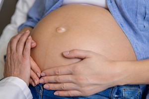 [팟캐스트] (688) 제왕절개 분만이 늘어나는 이유는?