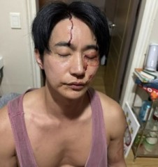 “성병 옮기고 폭행까지”…유명 남배우, 연인 폭로에 “허위사실”