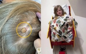 캠핑 다녀왔는데, 갑자기 ‘전신마비’된 4살 딸…머릿 속 ‘이것’때문이었다