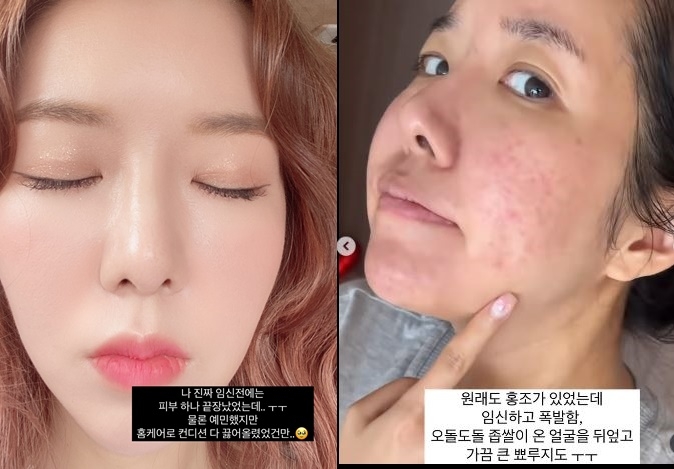 김지혜 채널