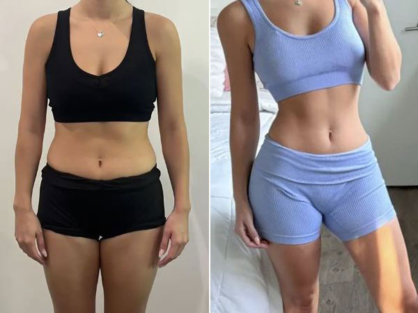 토토사이트 털림였던 30대 여성이 고기 등 동물성 식품을 섭취하면서 몸에 변화가 나타났다. 사진은 전과 후의 모습. [뉴욕포스트]
