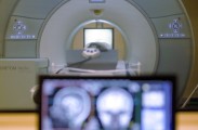 금속 목걸이 차고 있다 MRI 빨려 들어가…美 남성 끝내 사망