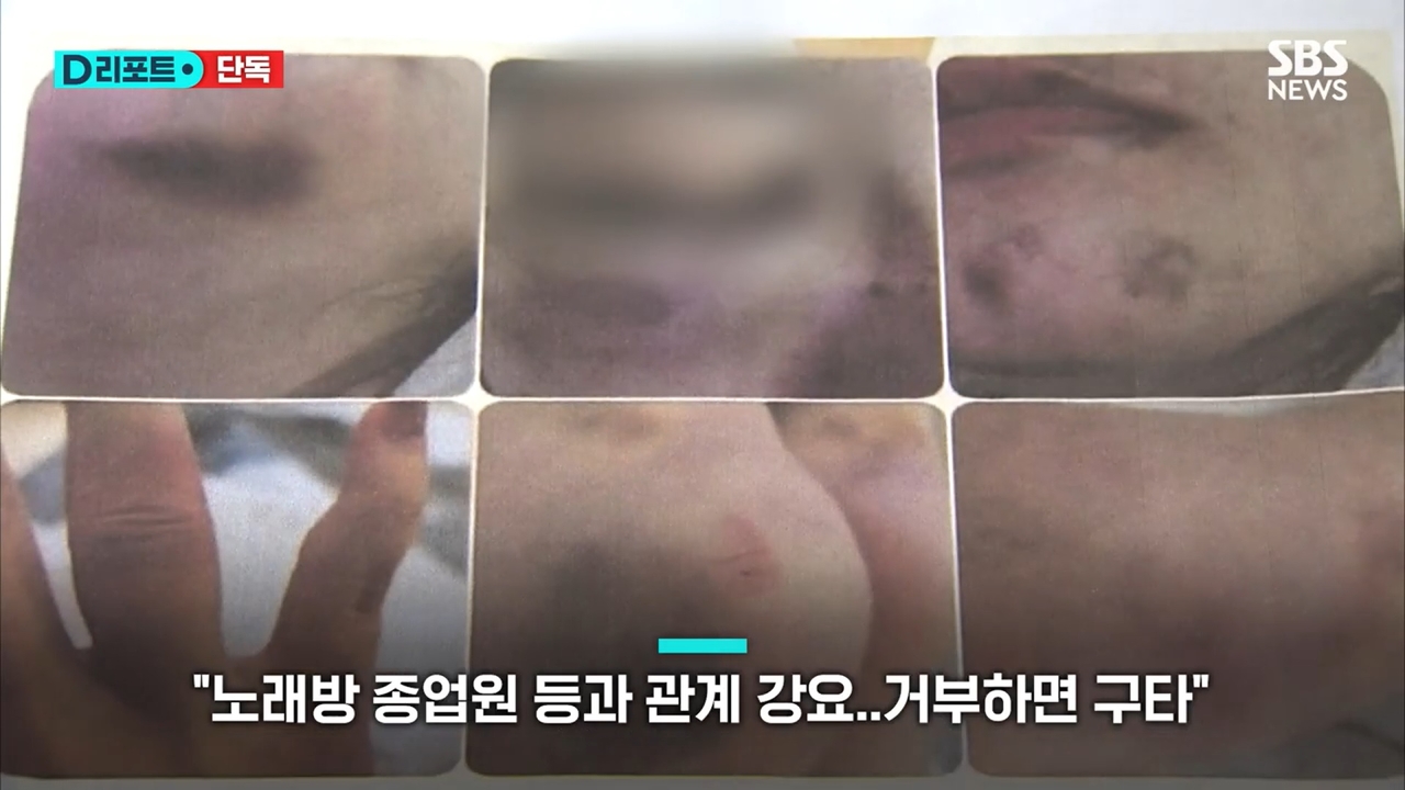B 씨가 남편으로부터 폭행을 당한 뒤 찍은 사진이라고 주장한 증거.[SBS 캡처]