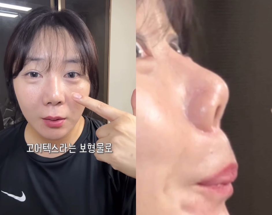 사진=허안나 SNS