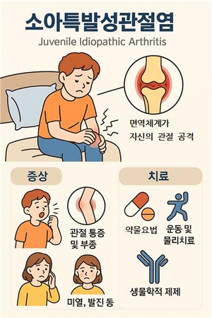 아이도 관절염? 충격적인 소아특발성관절염 발병률, 국내 연구진 밝혀! 류마티스 질환 예방·관리법