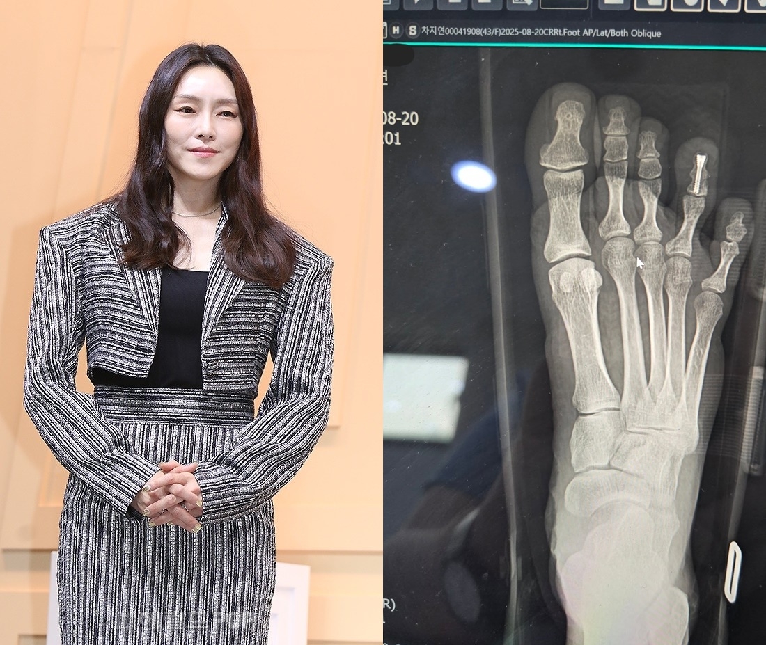 차지연/사진=헤럴드POP DB, SNS