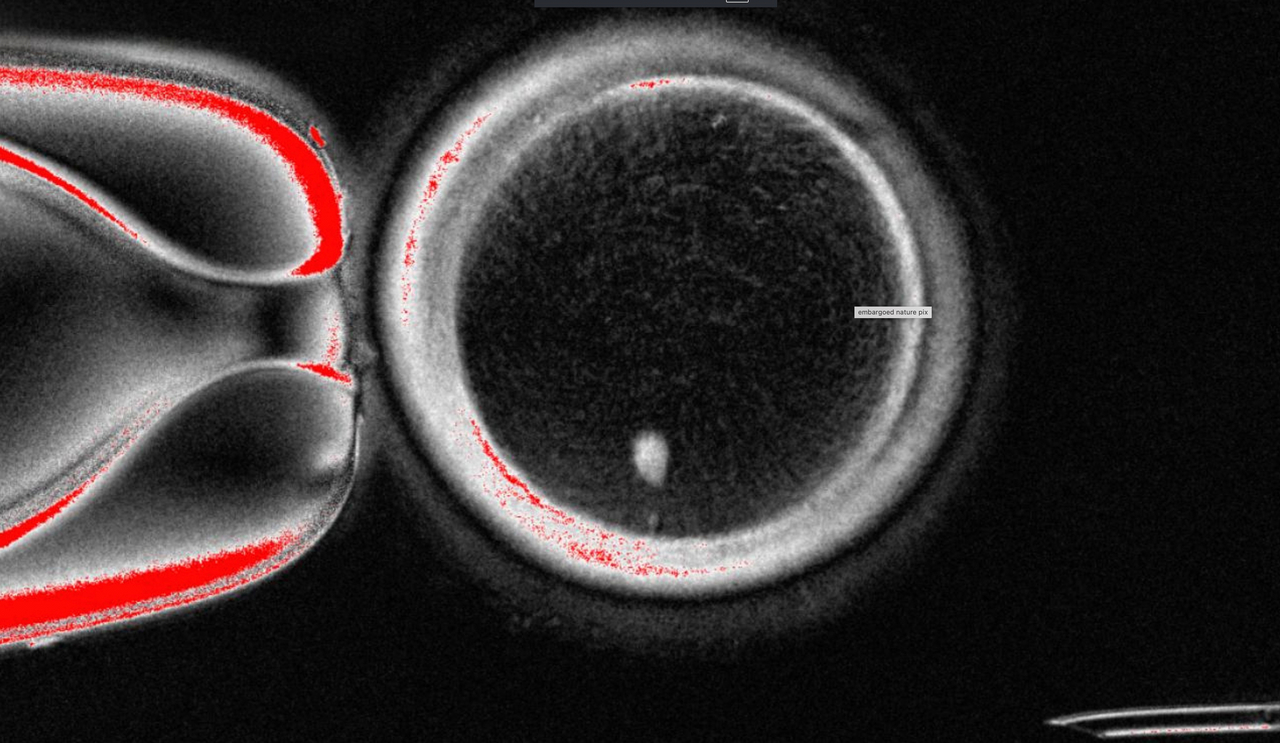 This image provided by the Mitalipov Laboratory at Oregon Health & Science University shows a a microscope image of a human egg that contains a nucleus taken from a skin cell.   AP-Yonhap