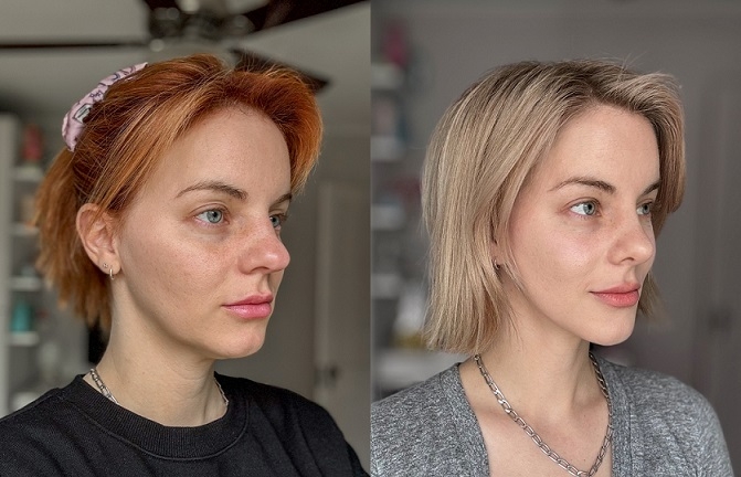 Images comparing Heidi Mae’s appearance before and after her face-lift, nose surgery and skin procedures. (Courtesy of Heidi Mae)