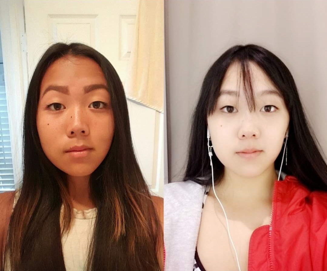 Images comparing Quinn Lin’s appearance before and after receiving a glutathione IV drip. (Quinn Lin)