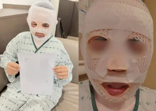 A Thai woman's face is covered in bandages after her husband allegedly poured boiling water on her face on Dec. 3. (Facebook)