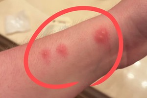 “모기가 아직도 있나?” 무심코 넘겼다간 ‘큰일’…끔찍한 일 벌어진다 [지구, 뭐래?]