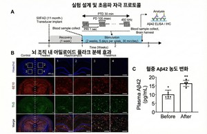 [김태열의 생생건강S펜] “국내연구진,약물 없이 초음파로 알츠하이머 원인 물질 65% 제거 확인”