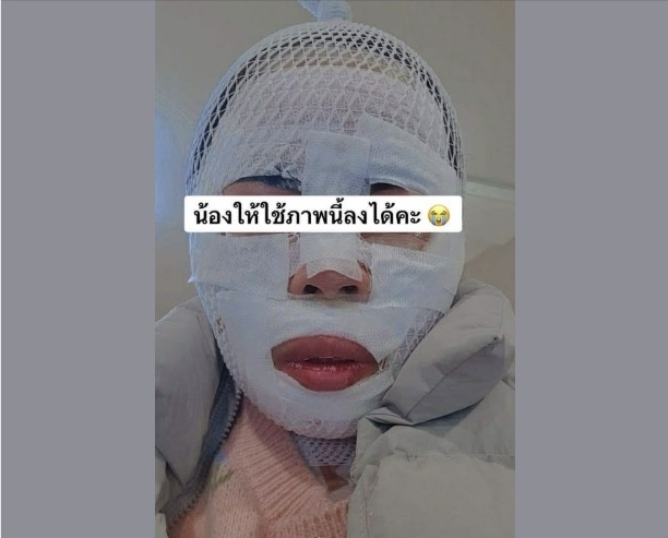 This image posted on Facebook shows the Thai victim in a recent scalding case. (Facebook via Yonhap)