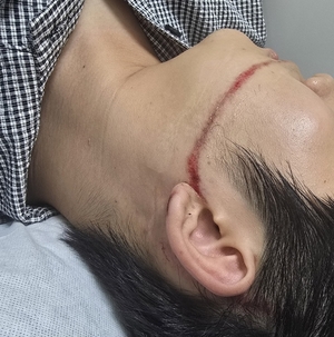 Water gun injury at summer fest sends organizers to prosecution