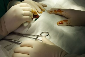 별안간 찾아온 ‘사지마비’…대리전 나선 국가도 ‘무릎’ 꿇었다 [메디컬 생존 게임]